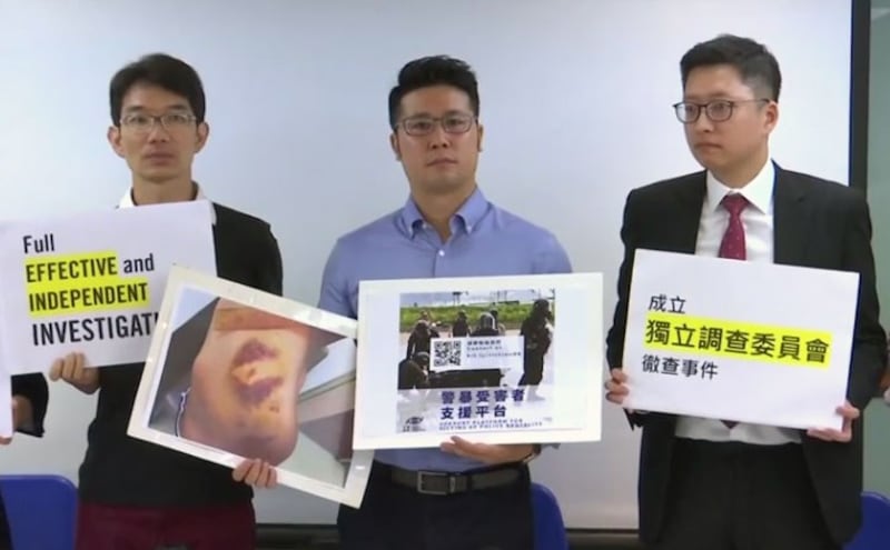 2019年6月24日,民权观察并且邀请国际特赦组织香港分会的代表召开记者会,图为香港民权观察,国际特赦组织香港分会代表,展示6-12警方清场行动中受伤的示威者伤势照片。(视频截图/路透社)
